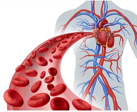 血管剪切应力血栓炎症​动脉粥样硬化模拟分析系统